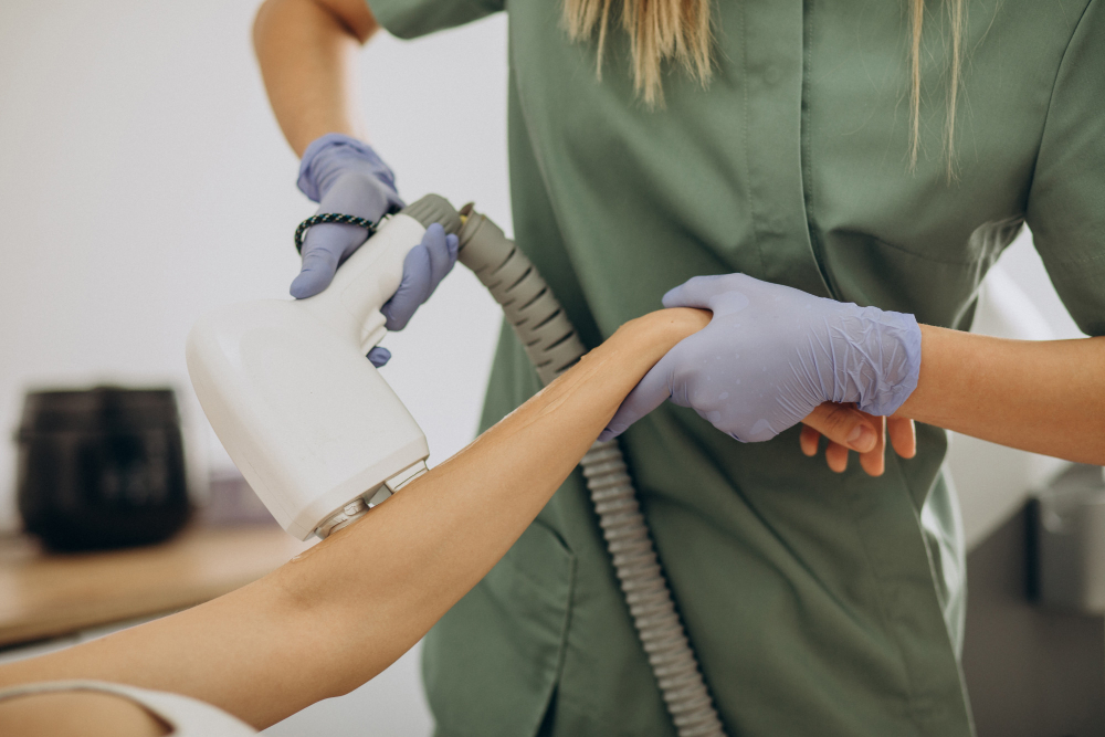 SHR odstranjevanje dlak